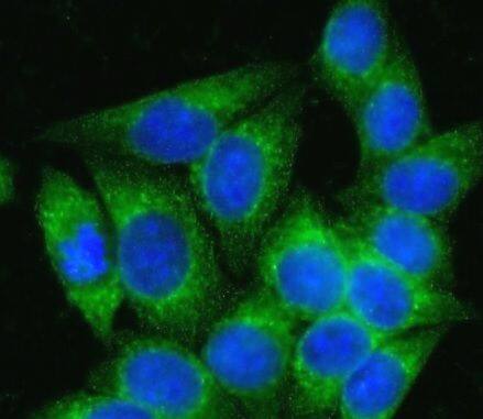 ALS2CR15 Antibody - BSA Free