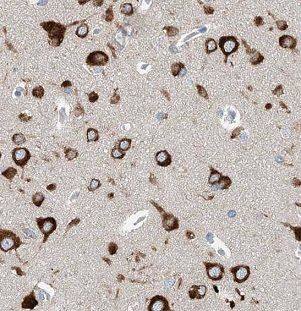 ALS2CR15 Antibody - BSA Free