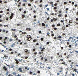 IARS2 Antibody - BSA Free