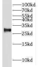 IAH1 Antibody - BSA Free