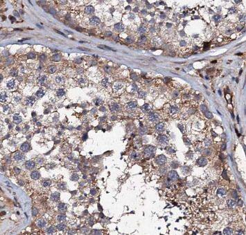 Hyaluronidase 4/HYAL4 Antibody - BSA Free