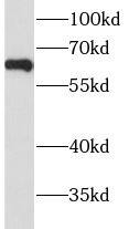 Hyaluronidase 4/HYAL4 Antibody - BSA Free