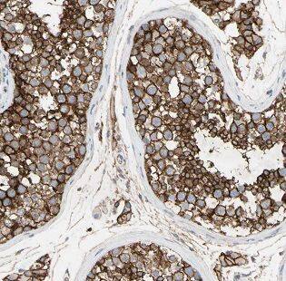 HYAL3 Antibody - BSA Free