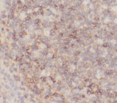 HVCN1 Antibody - BSA Free