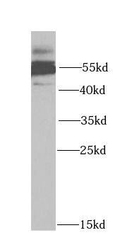 5-HT3A Antibody - BSA Free