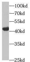 HSDL2 Antibody - BSA Free