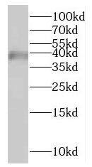HSDL1 Antibody - BSA Free
