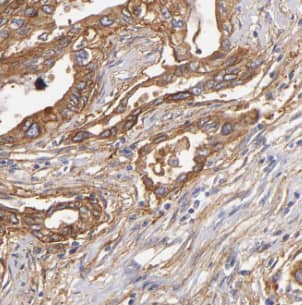 HSD3B7 Antibody - BSA Free