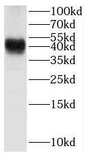 Beta Hydroxysteroid Dehydrogenase Antibody - BSA Free