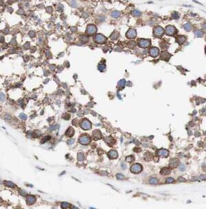 Beta Hydroxysteroid Dehydrogenase Antibody - BSA Free