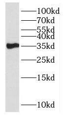 HSD17B7 Antibody - BSA Free