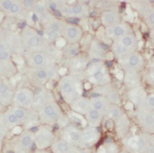 HSD17B7 Antibody - BSA Free