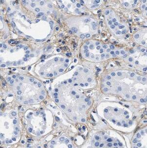 hydroxysteroid (17-beta) dehydrogenase 11 Antibody - BSA Free