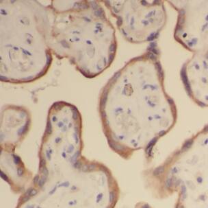 HRASLS5 Antibody - BSA Free