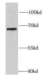 HPSE2 Antibody - BSA Free