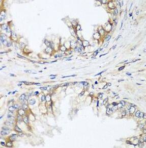 HPSE2 Antibody - BSA Free