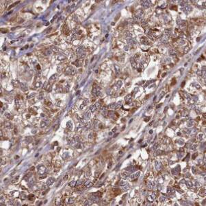 HPS6 Antibody - BSA Free
