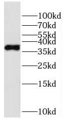 HPDL Antibody - BSA Free