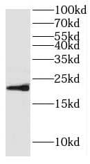 Hippocalcin like 4 Antibody - BSA Free