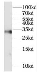 HOXD8 Antibody - BSA Free
