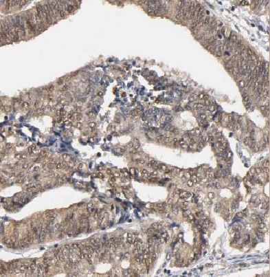 HLX1 Antibody - BSA Free