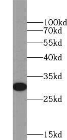 HLA DQB2 Antibody - BSA Free