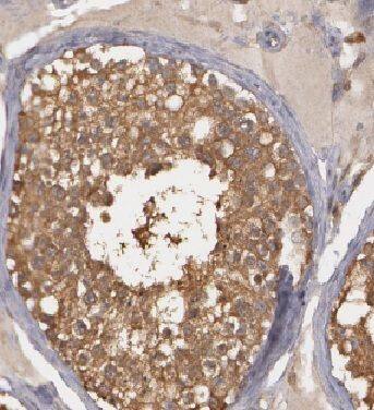 HIGD1A Antibody - BSA Free