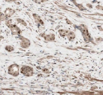 HEY2 Antibody - BSA Free