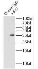 HEY2 Antibody - BSA Free