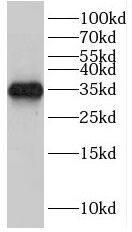 HEY2 Antibody - BSA Free