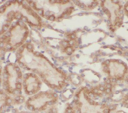 HERPUD2 Antibody - BSA Free
