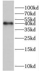 HERPUD2 Antibody - BSA Free