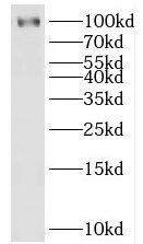 HECTD3 Antibody - BSA Free