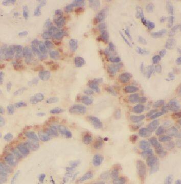 HEATR2 Antibody - BSA Free