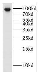 HEATR2 Antibody - BSA Free