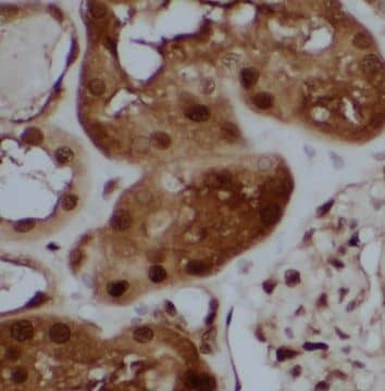 HDDC3 Antibody - BSA Free