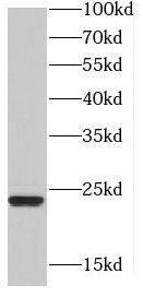 HD domain containing 2 Antibody - BSA Free