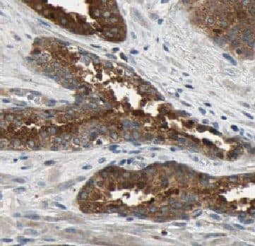 TPD52L1/D53 Antibody - BSA Free