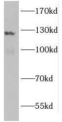 GUCY2F Antibody - BSA Free