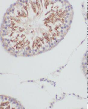 GTPBP5 Antibody - BSA Free