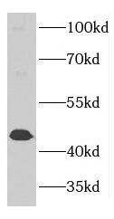 GTPBP5 Antibody - BSA Free