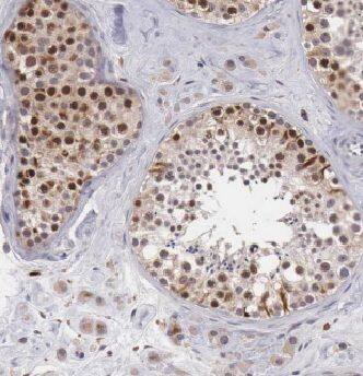 GTDC1 Antibody - BSA Free
