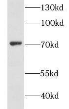 GSTCD Antibody - BSA Free