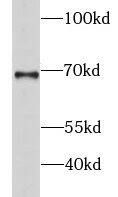 GSPT2 Antibody - BSA Free