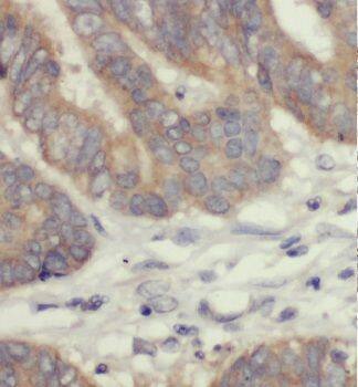 GSPT2 Antibody - BSA Free