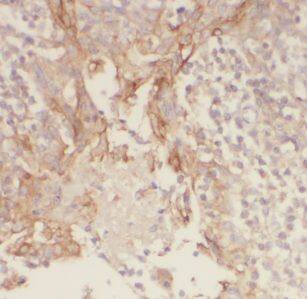 GSG1L Antibody - BSA Free
