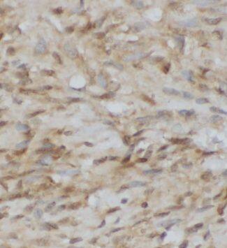 GOSR1 Antibody - BSA Free