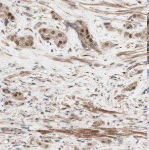 GRWD1 Antibody - BSA Free