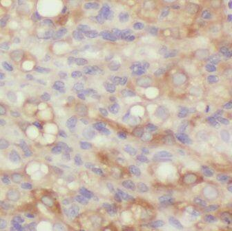 GRB 14 Antibody - BSA Free