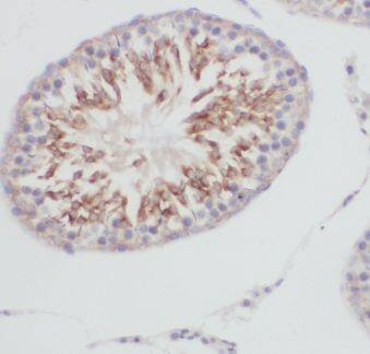 Glutathione Peroxidase 5 Antibody - BSA Free